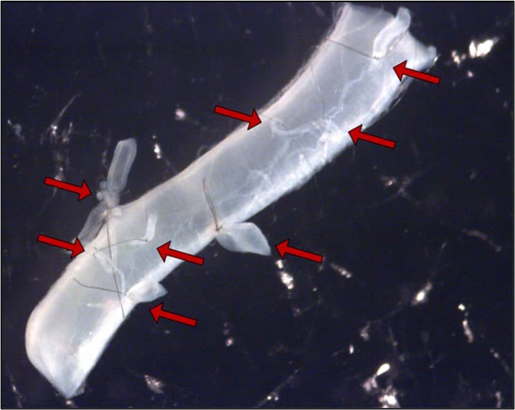 (Thesis) Analyzing the Softening Behavior of Brain Vessels